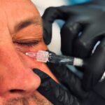 Luxia Mesotherapy Educational Video