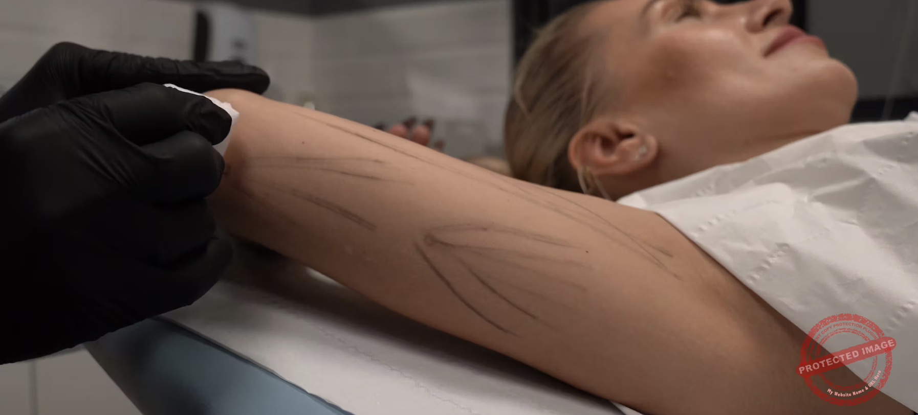endo arms educational video Endo Arms Educational Video - Image 1